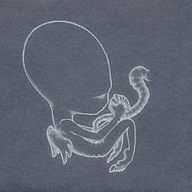 Agaetis Byrjun